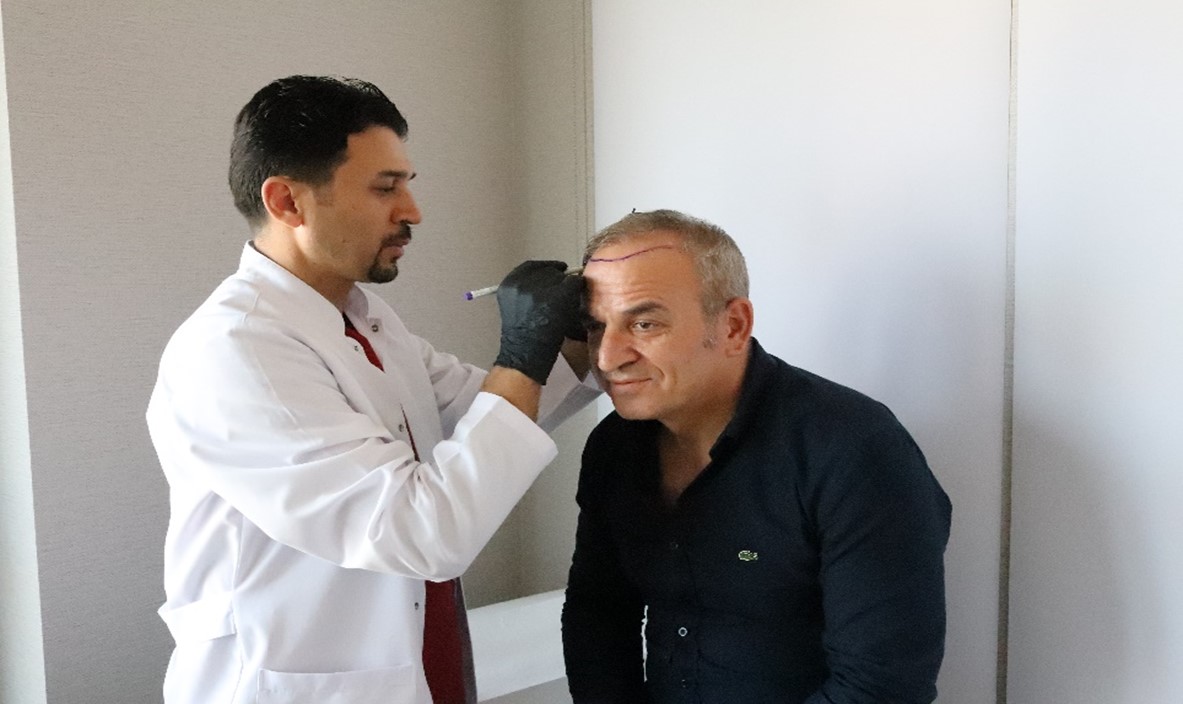 Hair Transplantation