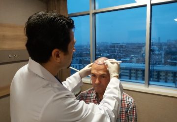 Hair Transplantation in Istanbul Turkey
