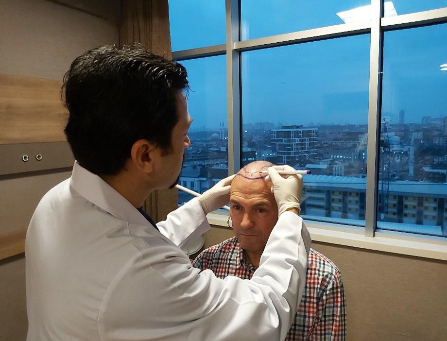 Hair Transplantation in Istanbul Turkey