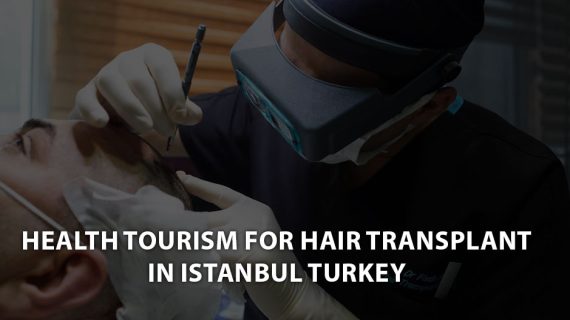 Health Tourism for Hair Transplant in Istanbul Turkey 2023